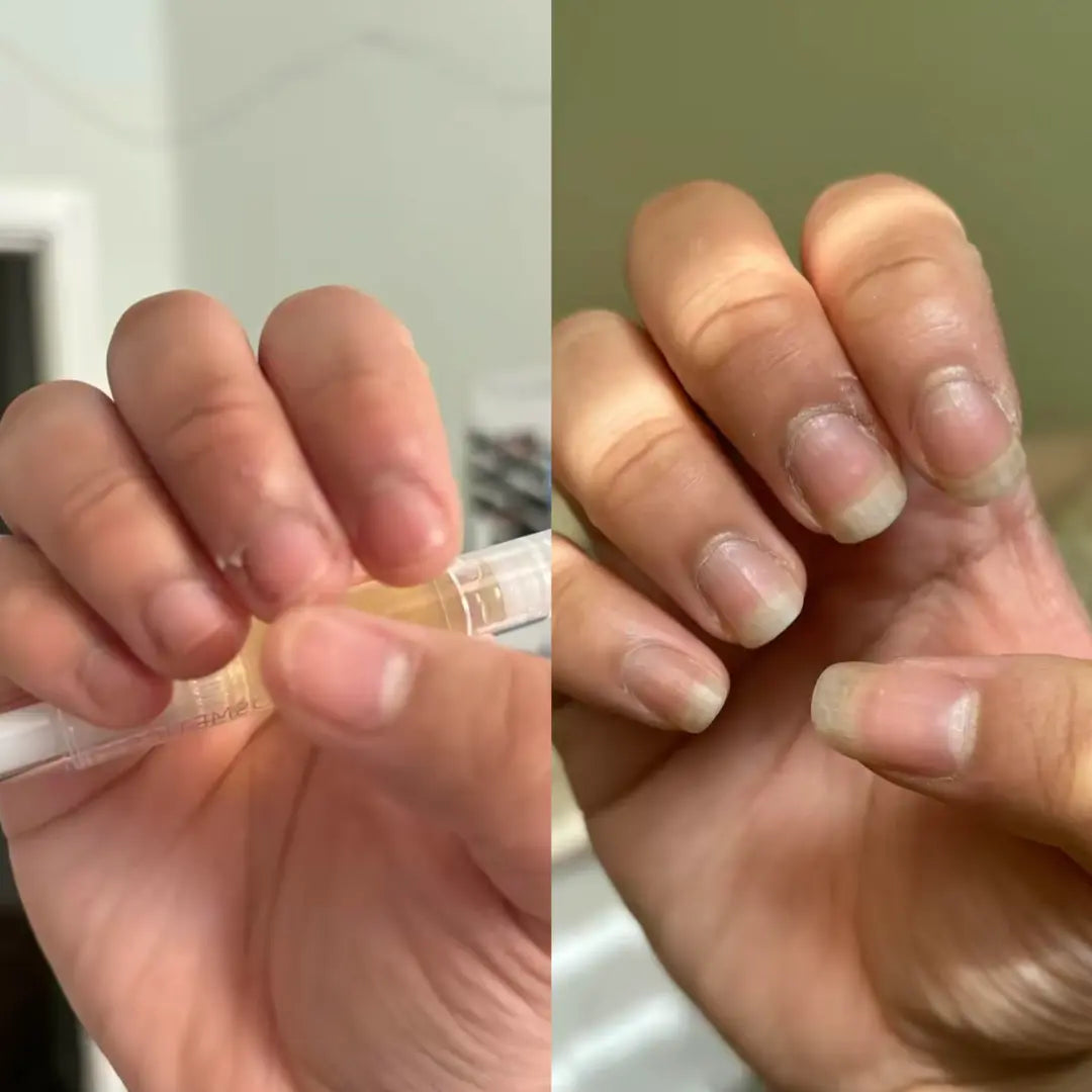 Radiant Cosmetics Nail Growth Oil - 100% Organic, Moisturizing, Growth, Strengthening, and Brightening Formula