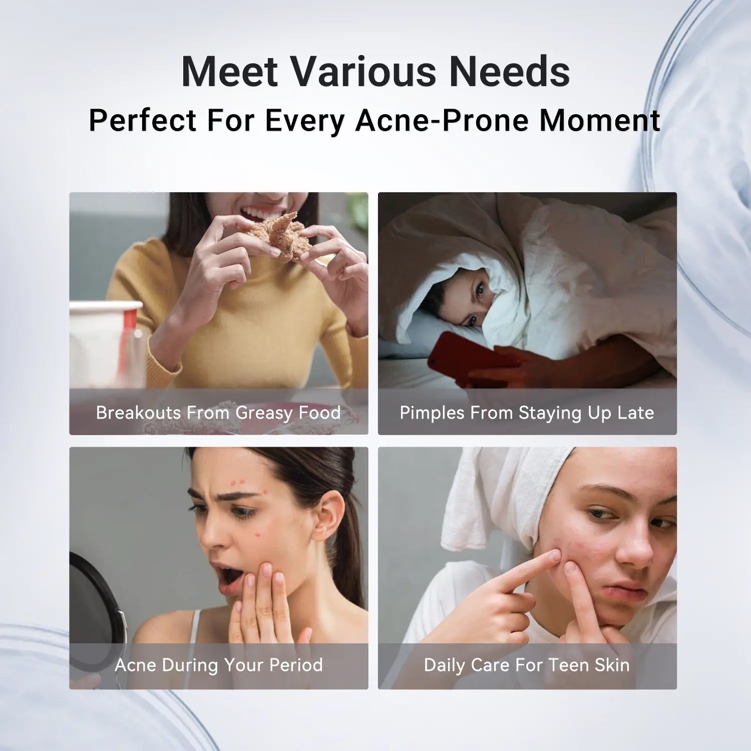 Dr.Leo Drying Lotion | Pimple Treatment & Body Acne Treatment 