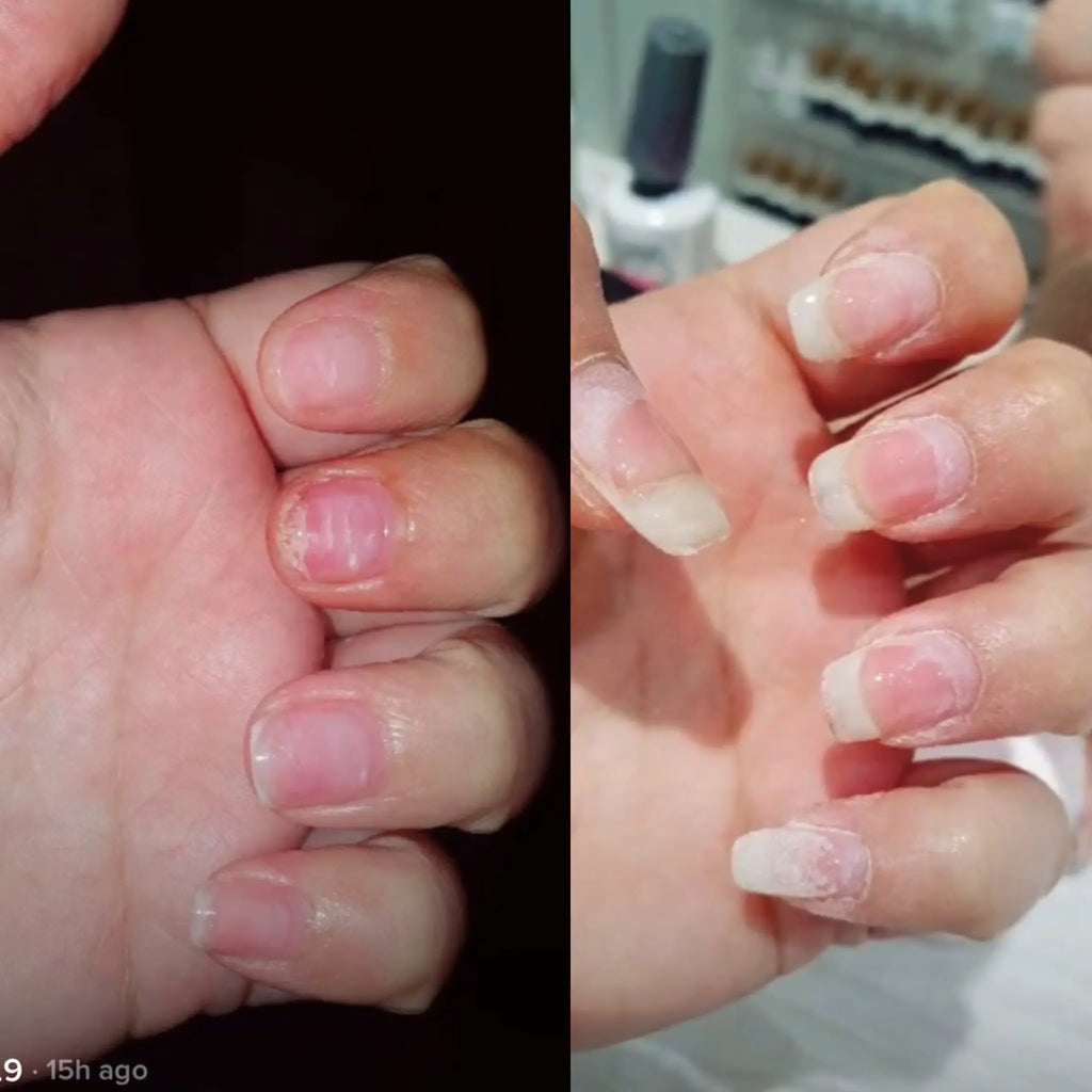 Radiant Cosmetics Nail Growth Oil - 100% Organic, Moisturizing, Growth, Strengthening, and Brightening Formula