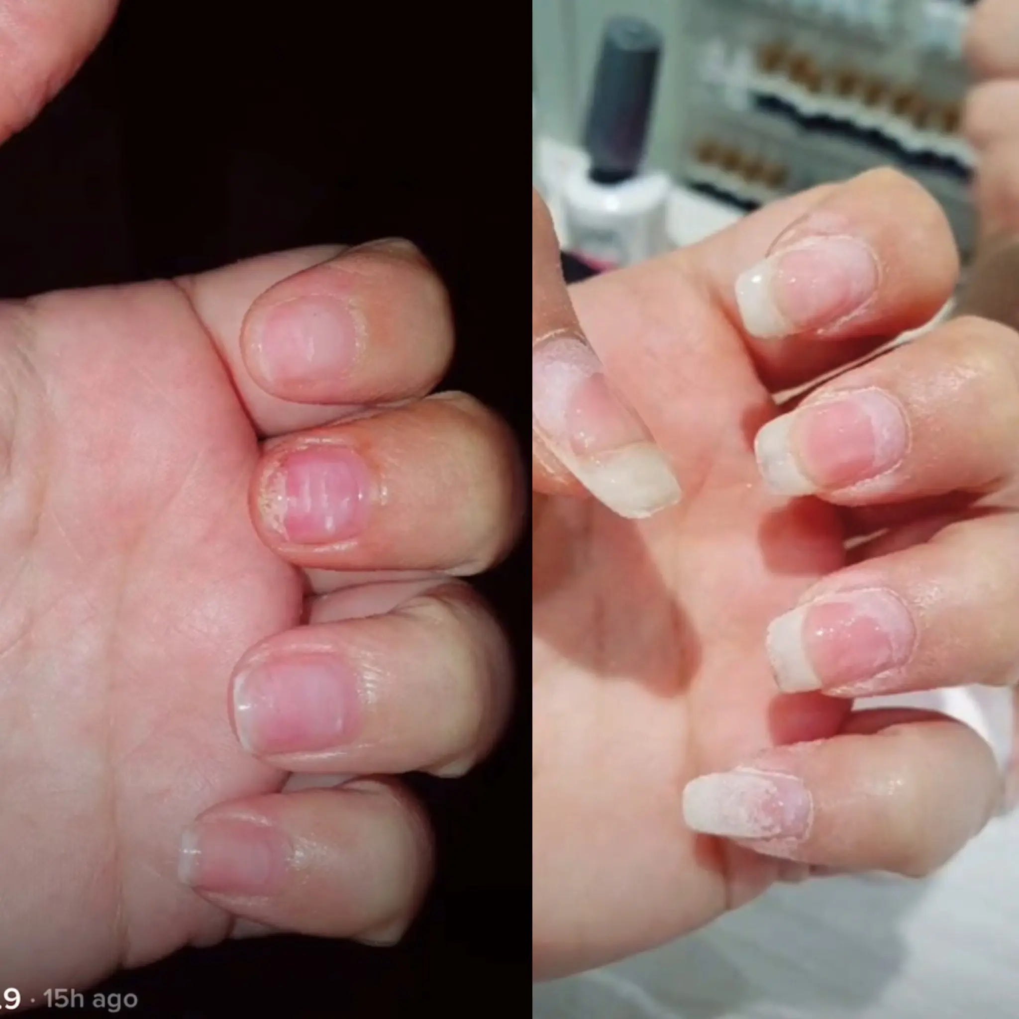 Radiant Cosmetics Nail Growth Oil - 100% Organic, Moisturizing, Growth, Strengthening, and Brightening Formula