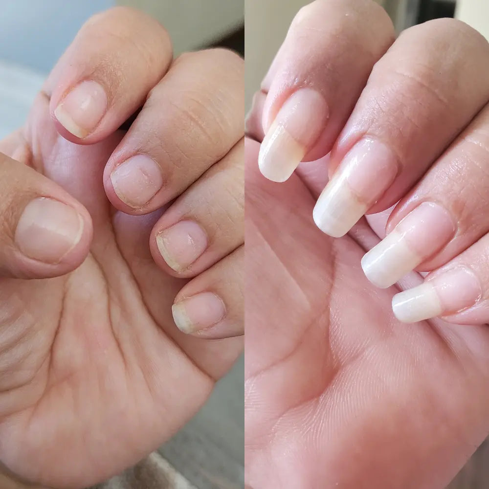 Radiant Cosmetics Nail Growth Oil - 100% Organic, Moisturizing, Growth, Strengthening, and Brightening Formula